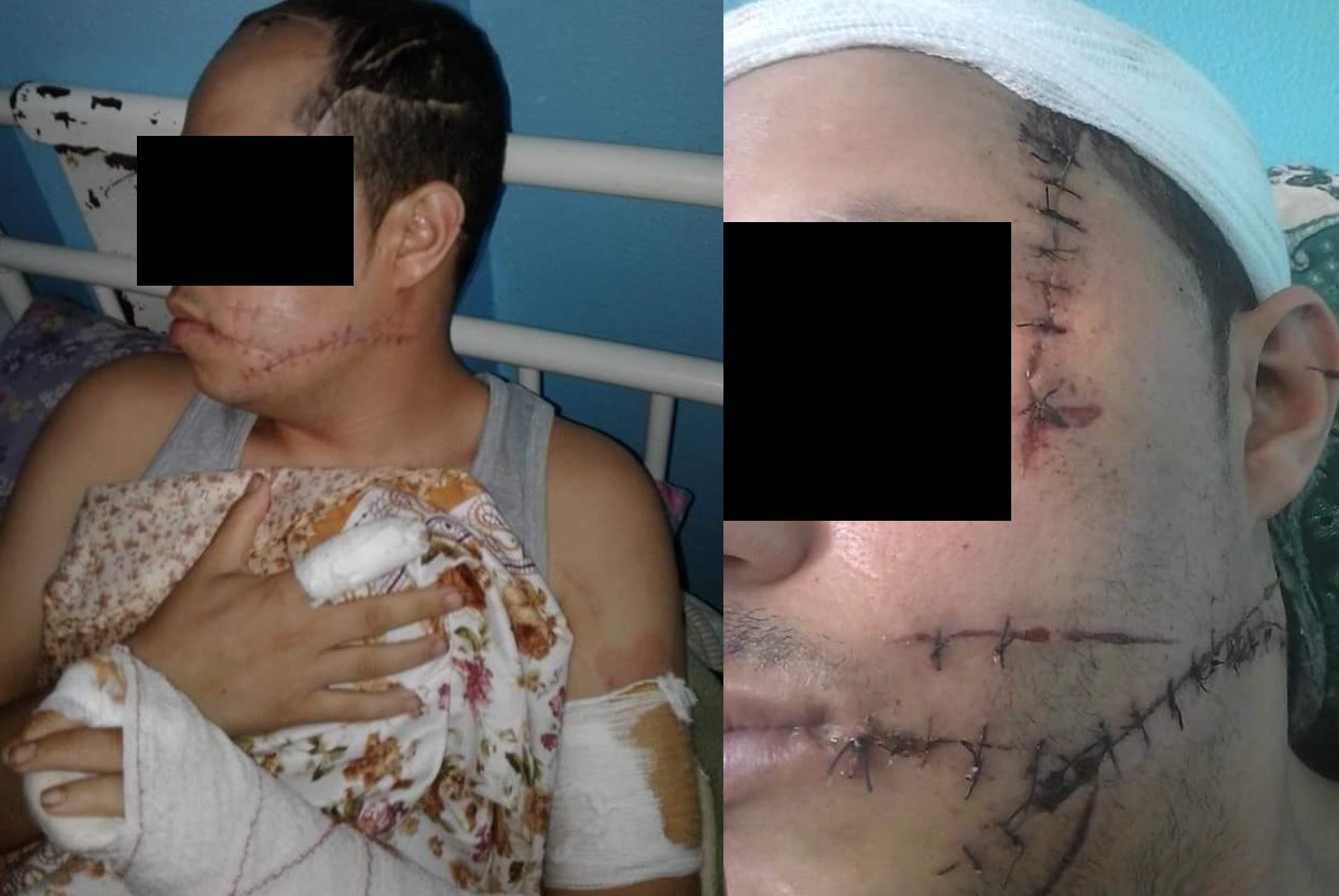 هذه قصة تعريض شخص لاعتداء وحشي بالسلاح الأبيض في القنيطرة