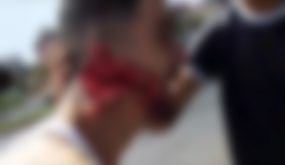 نشطاء مواقع التواصل الإجتماعي يفعلونها .. الدكتور التازي يتدخل على خط الشاب “المشرمل” بحي مولاي رشيد(فيديو)
