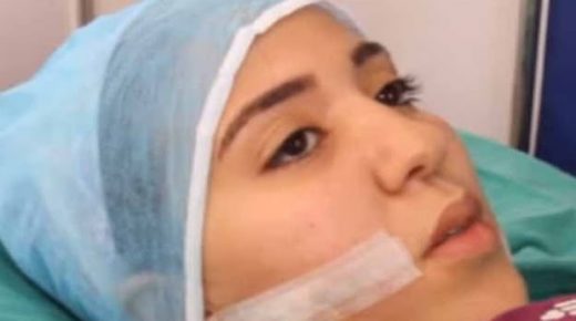 تفاصيل جديدة عن عملية إيقاف المشتبه فيه في تشويه وجه طليقته بالبيضاء