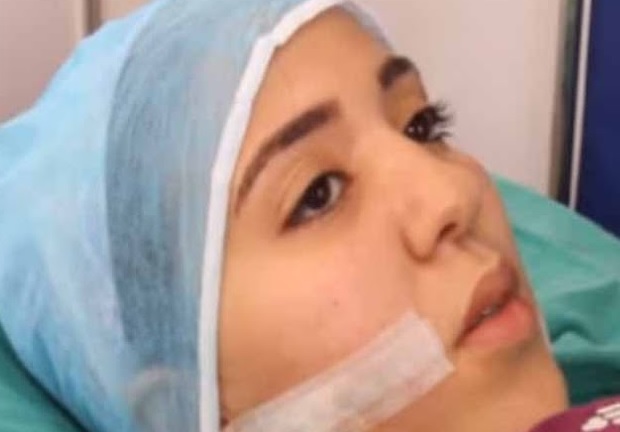 تفاصيل جديدة عن عملية إيقاف المشتبه فيه في تشويه وجه طليقته بالبيضاء