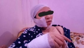 أمن البيضاء يوقف المشتبه فيه في تشويه وجه طليقته بسكين في سيدي رحال