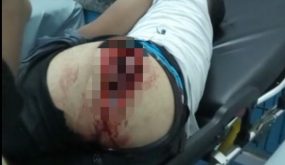 «القرقوبي» يتسبب في تمزيق «ولد عويطة» لمؤخرة شاب في البرنوصي