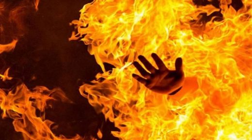 طالب التكوين المهني بالبيضاء الذي أضرم النار في جسده بعد حرقه أستاذته يفارق الحياة