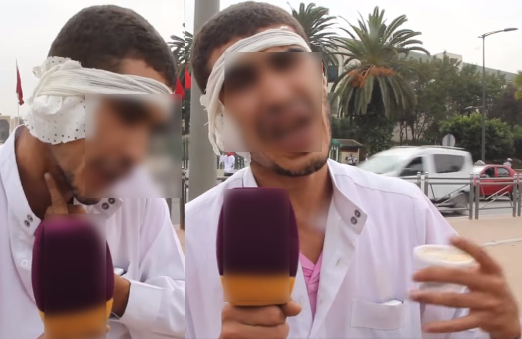 إيقاف المشتبه به بقضم أذن أحد أقربائه بالبيضاء