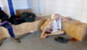إصابات في انهيار سقف حامة “عين الله” على رؤوس مستحمين (صور)
