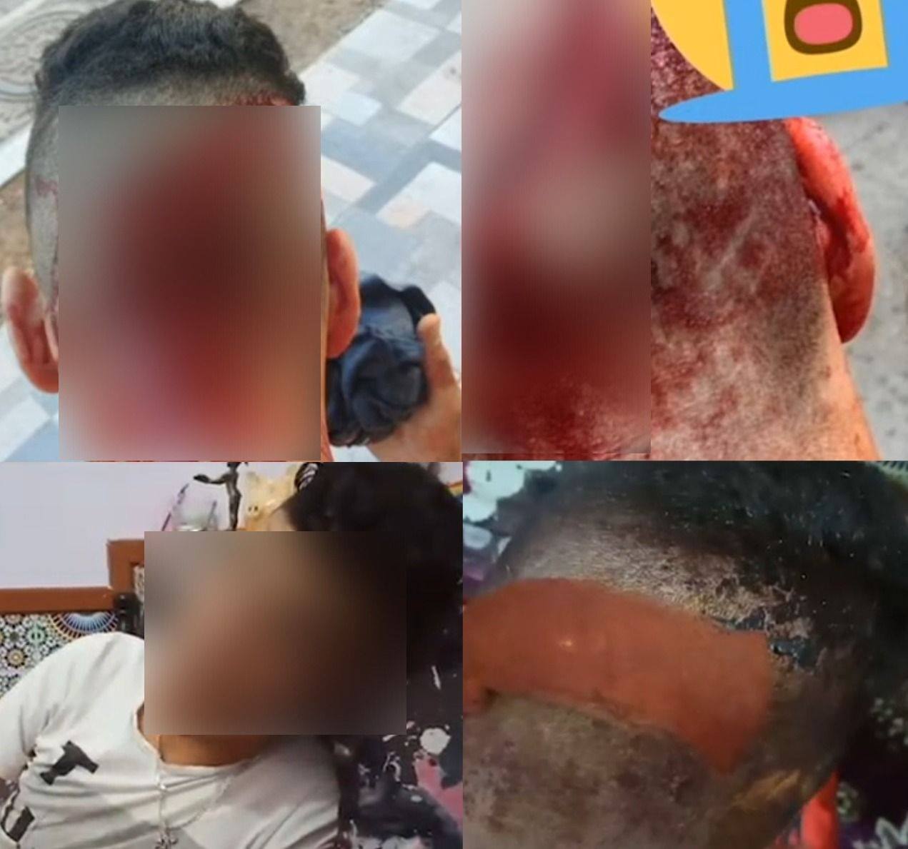 التحقيق في تعريض شخص لاعتداء وحشي في “الطوارئ الصحية” بالقنيطرة