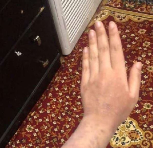 اكتشفت إصابتها ب (كورونا) صدفة عبر (فيسبوك)