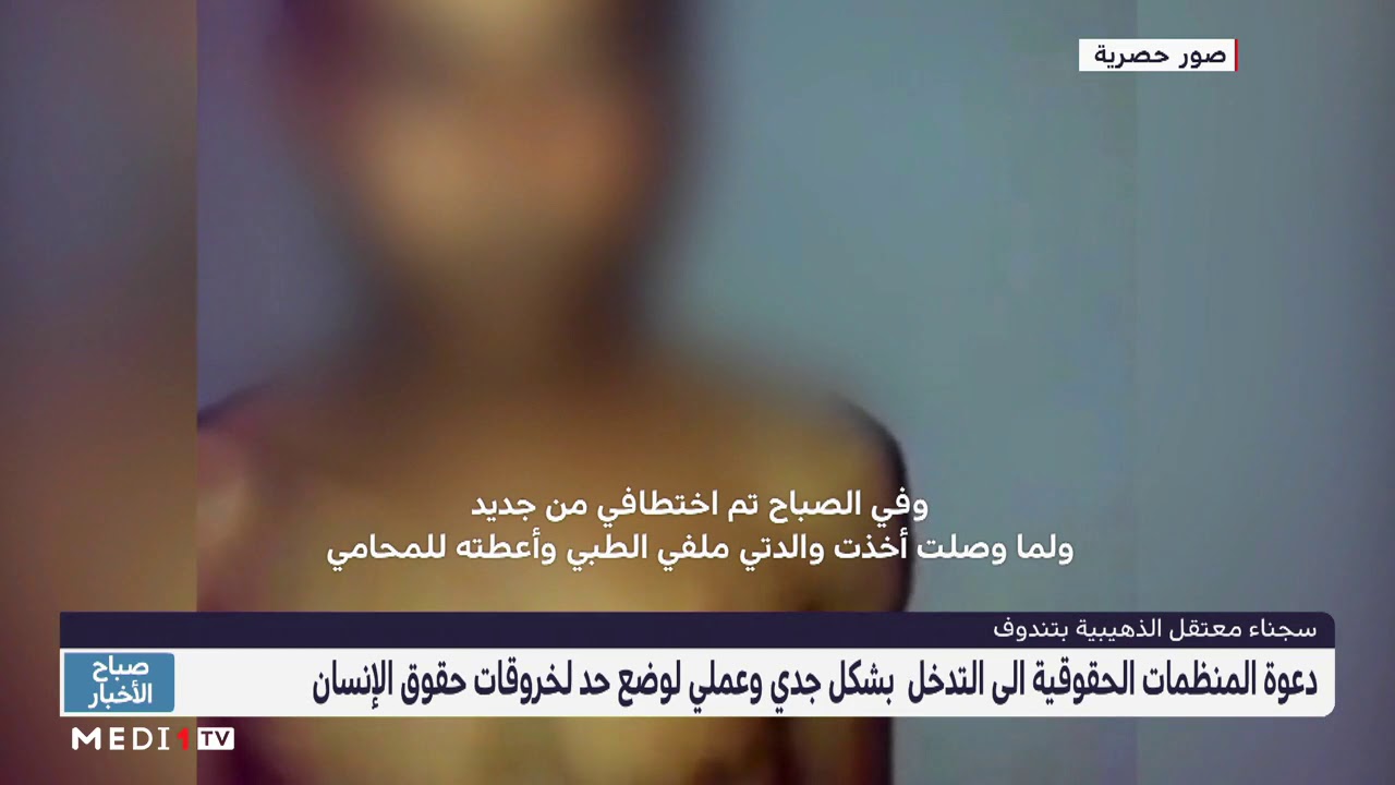 «ميدي 1 تي في» تبث حصريا فيديو يفضح التعذيب وانتهاكات حقوق الإنسان في سجون “البوليساريو”