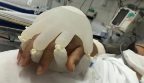 صورة مؤلمة من البرازيل تعكس حجم معاناة مرضى (كورونا) في المستشفيات