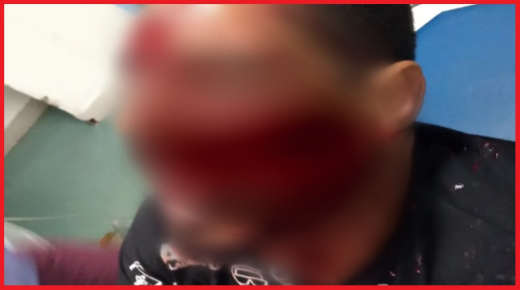 الإطاحة بثلاثيني “شرمل” شخص بالسلاح الأبيض في فاس