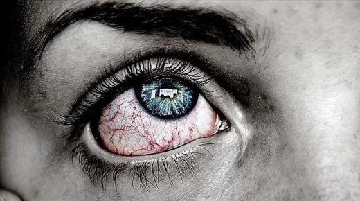 هكذا يؤثر (كوفيد ـ19) على صحة العين