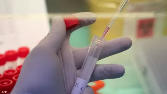دراسة: متحورة أوميكرون “الشبح” معدية أكثر من الأصلية