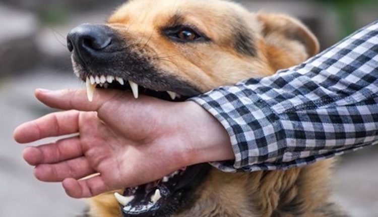 وفاة طفلين نتيجة تعرضهما لعضة كلب مسعور