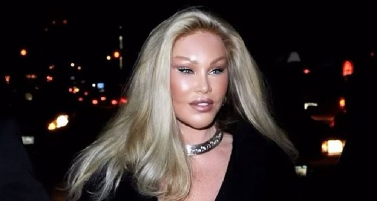 وفاة جوسلين ويلدنستين الخاضعة مرارا لعمليات تجميل لوجهها