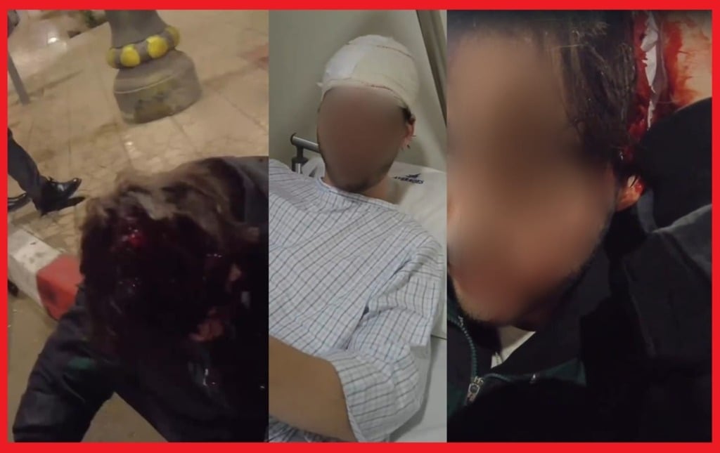 هذه قصة المحتوى الرقمي الذي ظهر فيه أجنبي مصابا في الرأس بمراكش